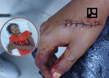 Padre hiere hija en «El Manguito» cuando corregía por parar en su casa