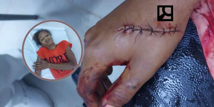 Padre hiere hija en «El Manguito» cuando corregía por parar en su casa