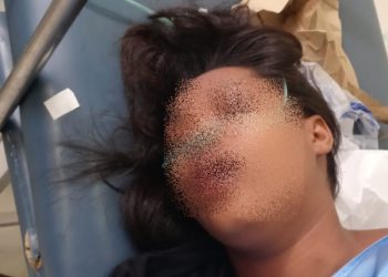 Hieren de bala joven en «tiroteo» anoche en La Guázara