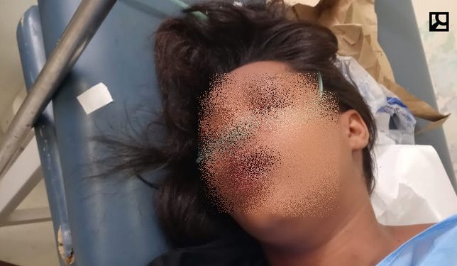 Hieren de bala joven en «tiroteo» anoche en La Guázara