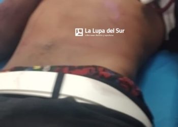 Un muerto y dos heridos en tiroteo en Baitoíta, Barahona