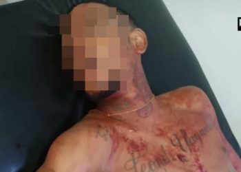 Matan a «Ricky Teilon» en la capital