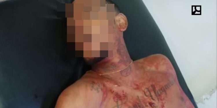 Matan a «Ricky Teilon» en la capital