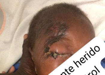 Guardias que hacian de agentes migratorios «hieren bebé» de un año