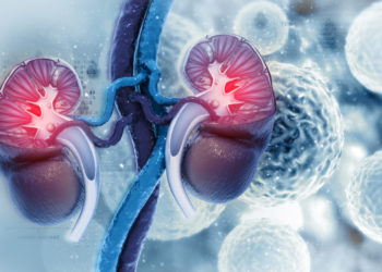 Cáncer Renal provoca más de 3,000 muertes al año
