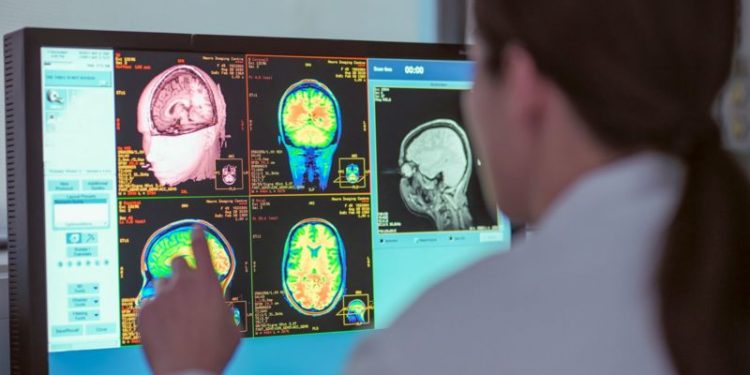 Ilusión de frecuencia: el fenómeno que hace que veas algo por todas partes después de haber hablado sobre ello