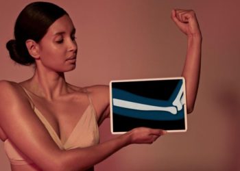La importancia de la salud ósea y los hábitos que te ayudan a conservarla