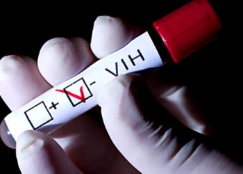 79,000 viven con vih en RD