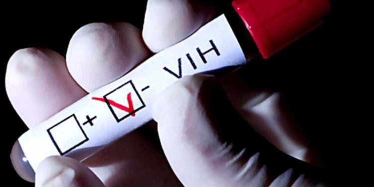 79,000 viven con vih en RD