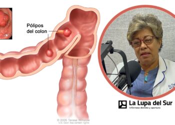 Cáncer de colon tiene alta incidencia en el Sur