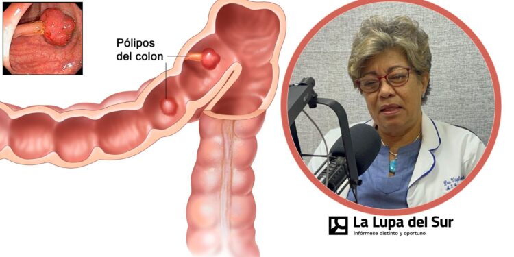 Cáncer de colon tiene alta incidencia en el Sur