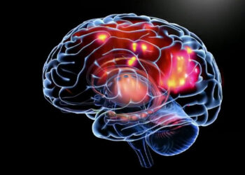 Epilepsia: Un trastorno neurológico que afecta a miles en RD