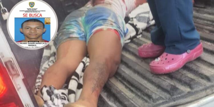 Identifican como «El Pájaro» joven que mató Dicrim en El Palmar