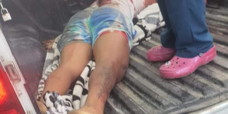 Miembros del Dicrim «acribillan» joven