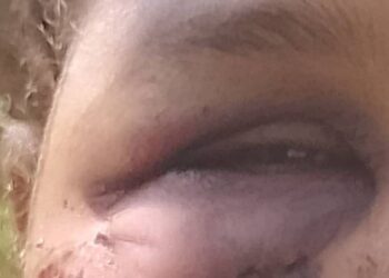 «Tigre» tenía orden de alejamiento de Mecho y casi la mata