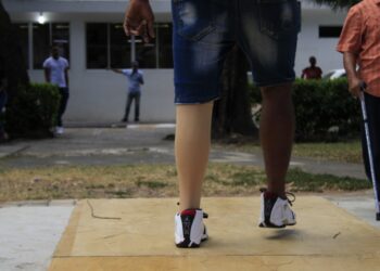 Rehabilitación y 2FT Prosthetics donan 75 prótesis femorales a amputados