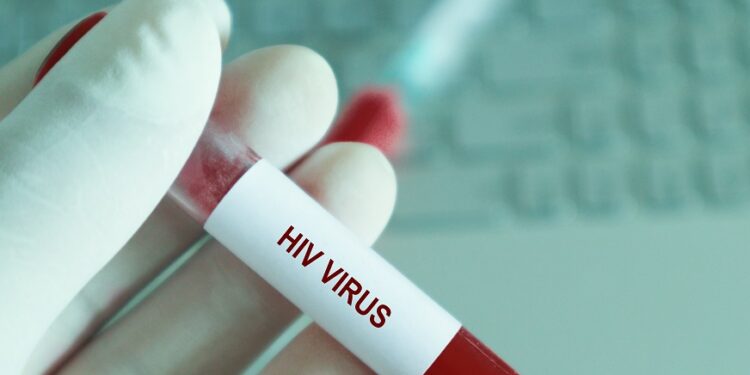 Primera curación de VIH mediante trasplante de celulas madres