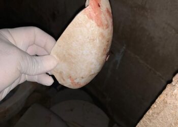 Hombre drogado se suicida en el sector Naco de Barahona