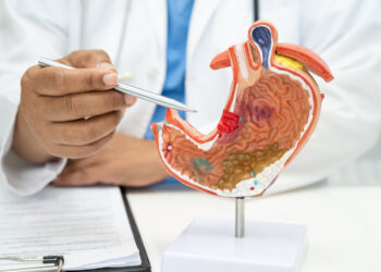 Cáncer de páncreas puede prevenirse con hábitos saludables