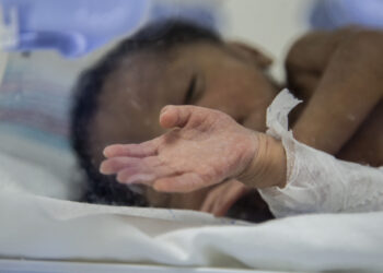 Emergencias «atestadas» por virus respiratorios