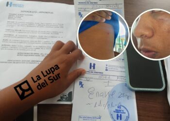 Hieren a estudiante en pelea en liceo de Duvergé