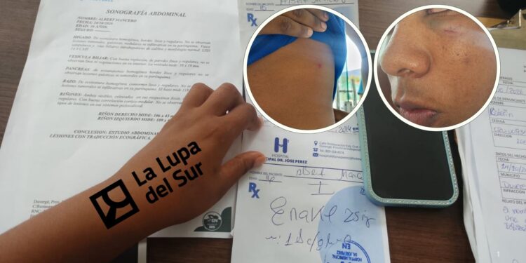 Hieren a estudiante en pelea en liceo de Duvergé